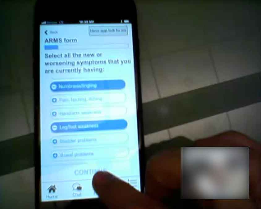  screenshot of the usability test with the participant tapping selections on the list in option 1 of the survey of the mobile app prototype. There is a thumbnail of the participant's face blurred out in the bottom right